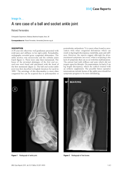 A rare case of a ball and socket ankle joint