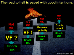 Defibrillation threshold testing should no longer be performed.: Pro.