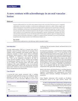 A new venture with sclerotherapy in an oral vascular lesion