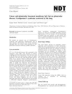Goodpasture`s syndrome restricted to the lung