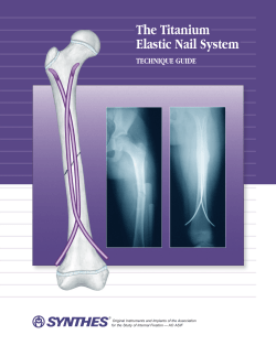 The Titanium Elastic Nail System Technique Guide