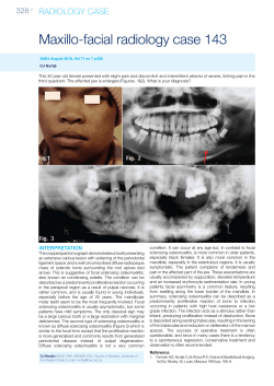Maxillo-facial radiology case 143