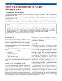 Radiologic Appearances in Fungal Rhinosinusitis