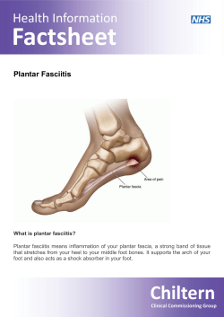 Plantar Fasciitis