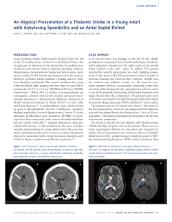 An Atypical Presentation of a Thalamic Stroke in a Young Adult with