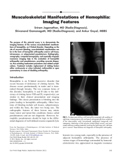 Musculoskeletal Manifestations of Hemophilia: Imaging Features