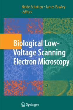 The Early Development of the Scanning Electron Microscope