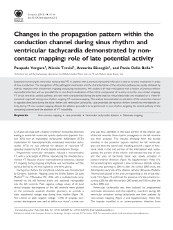 Changes in the propagation pattern within the conduction channel