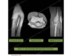 What`s the Diagnosis – Case 40