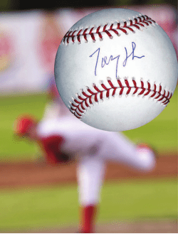 304 - Ulnar Collateral Ligament Reconstruction