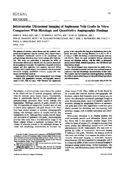 Intravascular ultrasound imaging of saphenous vein grafts in