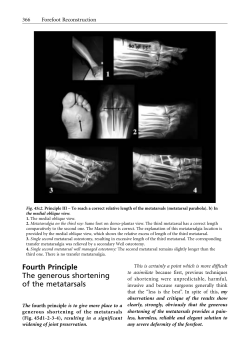 Fourth Principle The generous shortening of the metatarsals