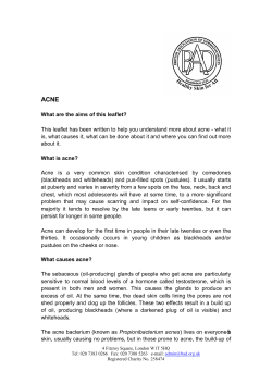 Acne - Dorset HealthCare