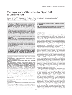 The Importance of Correcting for Signal Drift in Diffusion MRI