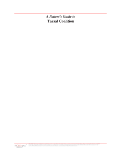 Tarsal Coalition