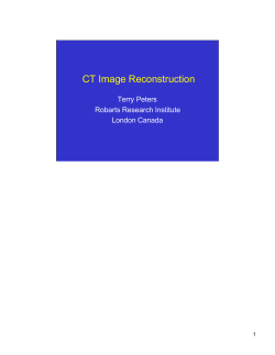 CT Image Reconstruction