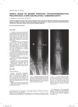 nora`s lesion or bizarre parosteal osteochondromatous proliferation