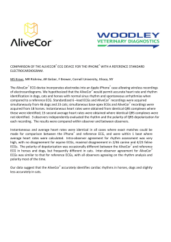 comparison of the alivecor with a reference