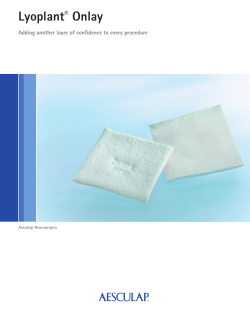 Lyoplant&reg; Onlay