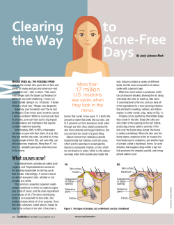 Clearing the Way to Acne-Free