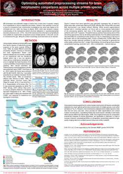 Optimizing automated preprocessing streams for brain