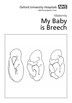 My Baby is Breech - Oxford University Hospitals