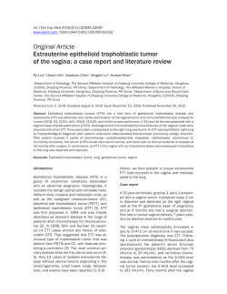 Extrauterine epithelioid trophoblastic tumor of the vagina: a case