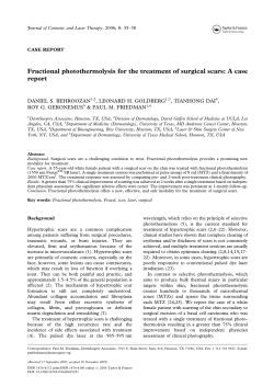 Fractional photothermolysis for the treatment of surgical scars: A