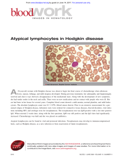 Atypical lymphocytes in Hodgkin disease