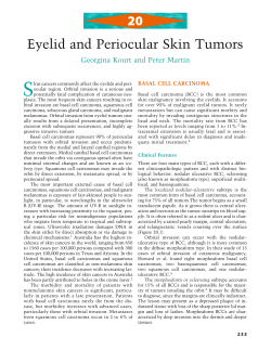 20 Eyelid and Periocular Skin Tumors