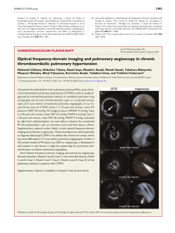 Optical frequency-domain imaging and pulmonary angioscopy in