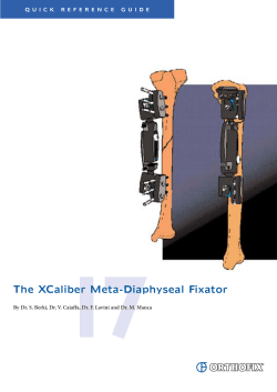The XCaliber Meta-Diaphyseal Fixator