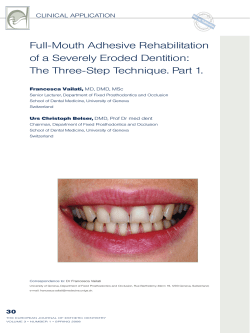 The Three-Step Technique. Part 1.