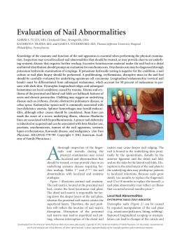 Evaluation of Nail Abnormalities