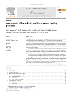 Assessment of burn depth and burn wound healing