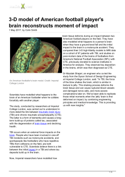 3-D model of American football player`s brain