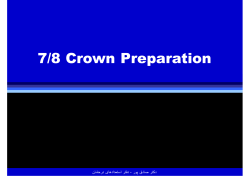 7/8 Crown Preparation