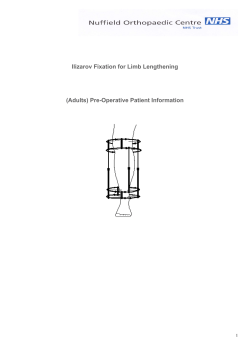 Ilizarov Fixation for Limb Lengthening