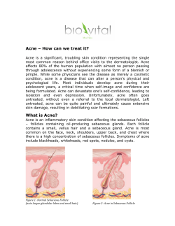 Acne &ndash; How can we treat it? What is Acne?