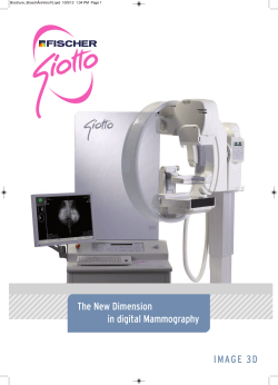 Giotto Digital Mammography System