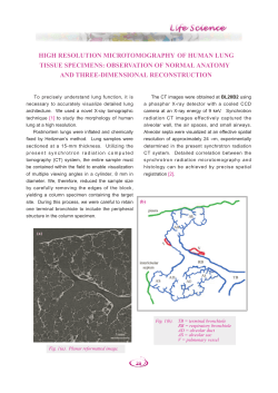 high resolution microtomography of human lung tissue - SPring-8