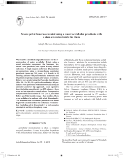 Severe pelvic bone loss treated using a coned acetabular prosthesis