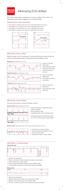 Minimizing ECG Artifact