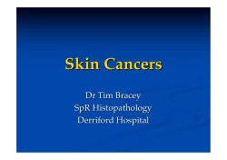 Skin Cancers