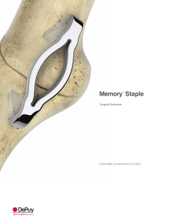 Memory&trade; Staple