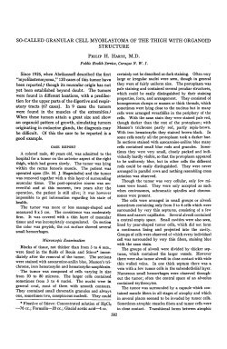 so-called granular cell myoblastoma of the thigh with organoid
