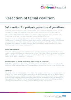 Resection of tarsal coalition - patient information