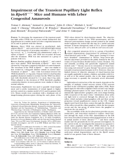 Impairment of the Transient Pupillary Light Reflex in Rpe65 Mice